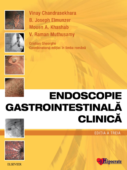 Endoscopie Gastrointestinala Clinica (LIVRARE: 15 ZILE)