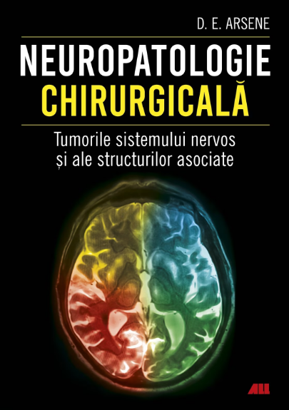 Neuropatologie chirurgicala. Tumorile sistemului nervos si ale structurilor asociate (LIVRARE: 15 ZILE) 